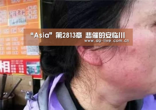 “Asia”第2813章 悲催的安临川(图2)